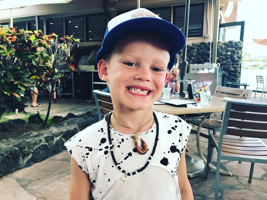 12 augustus: Kid warrior had to have a tooth pulled in Hawaii. The Hawaiian tooth fairy is V generous. And luc is rocking this gap like a champ
